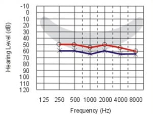آشنایی با درجات مختلف افت شنوایی
