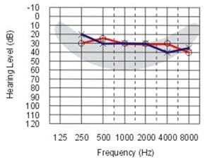 آشنایی با درجات مختلف افت شنوایی