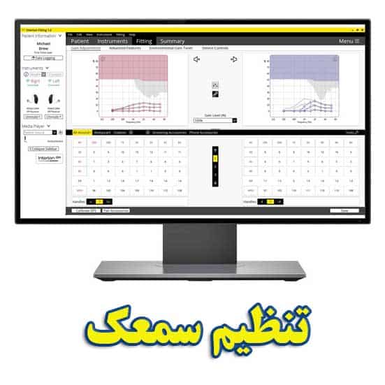 تنظیم سمعک