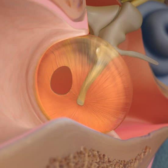 1619949828 کلینیک کاشن - پارگی پرده ی گوش