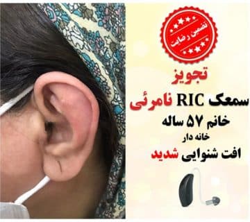1625114291 2 کلینیک کاشن - تجویز سمعک نامرئی RIC برای خانم 57 ساله