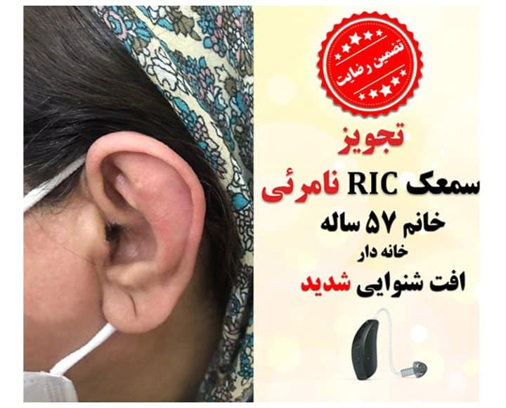 1625114291 2 کلینیک کاشن - تجویز سمعک نامرئی RIC برای خانم 57 ساله