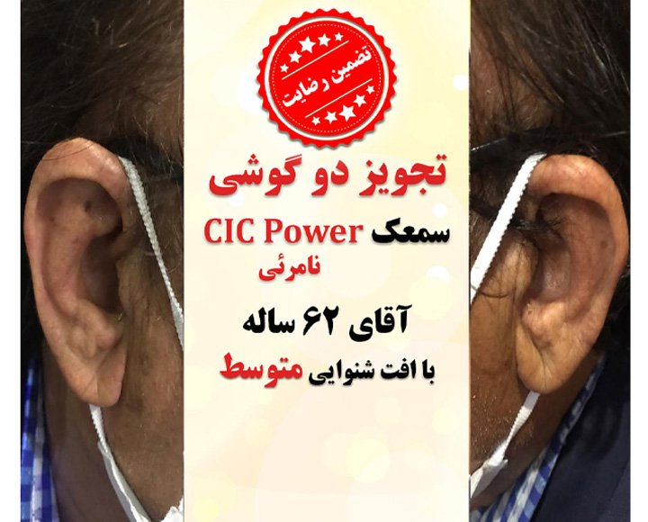 1625115907 5 کلینیک کاشن - تجویز 2 عدد سمعک نامرئی cic power برای آقای 62 ساله