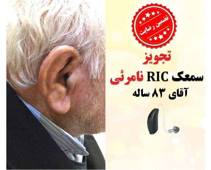 1625462203 10 کلینیک کاشن - تجویز سمعک نامرئی رسیور در کانال برای آقای 83 ساله