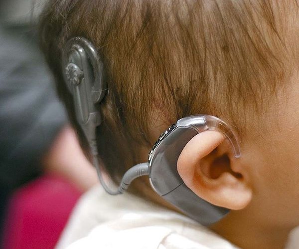 تفاوت کاشت حلزون و سمعک