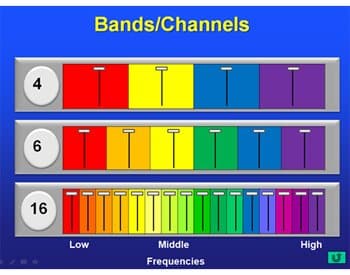 تعداد کانال و باند سمعک