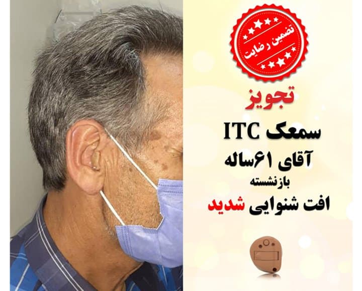 1625115066 6a 1 کلینیک کاشن - تجویز سمعک ITC برای آقای 61 ساله