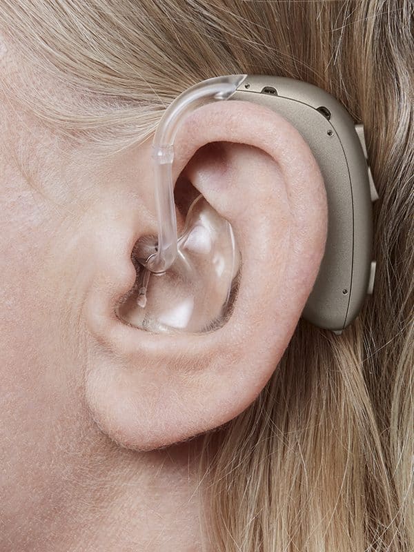 برای افت شنوایی عمیق چه سمعکی مناسب است