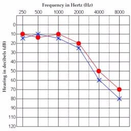 ادیوگرام چیست؟