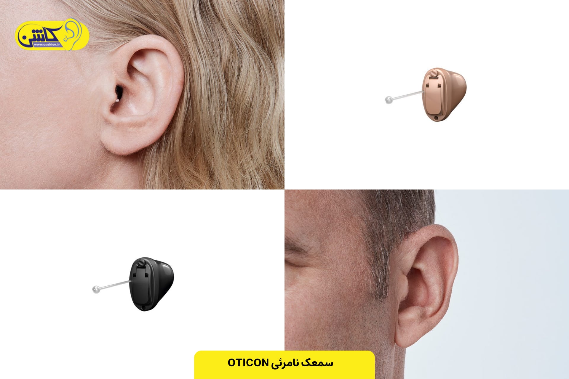 سمعک نامرئی اتیکن